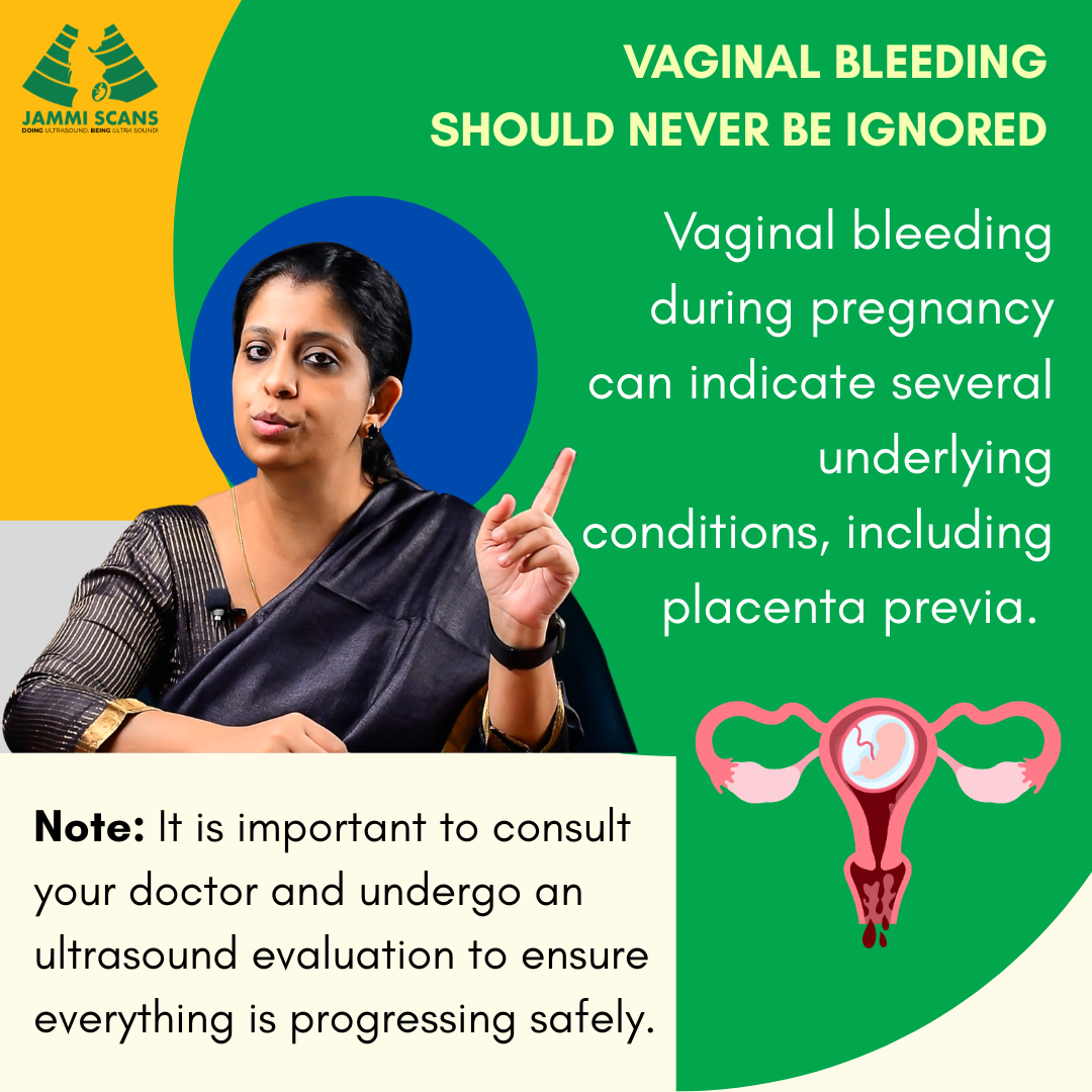 Dr. Deepthi Jammi Placenta Previa