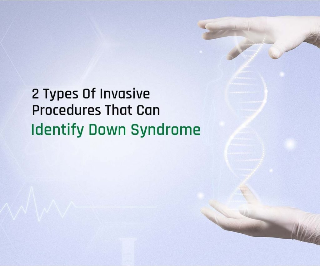 Types Of Invasive Procedures That Can Identify Down Syndrome
