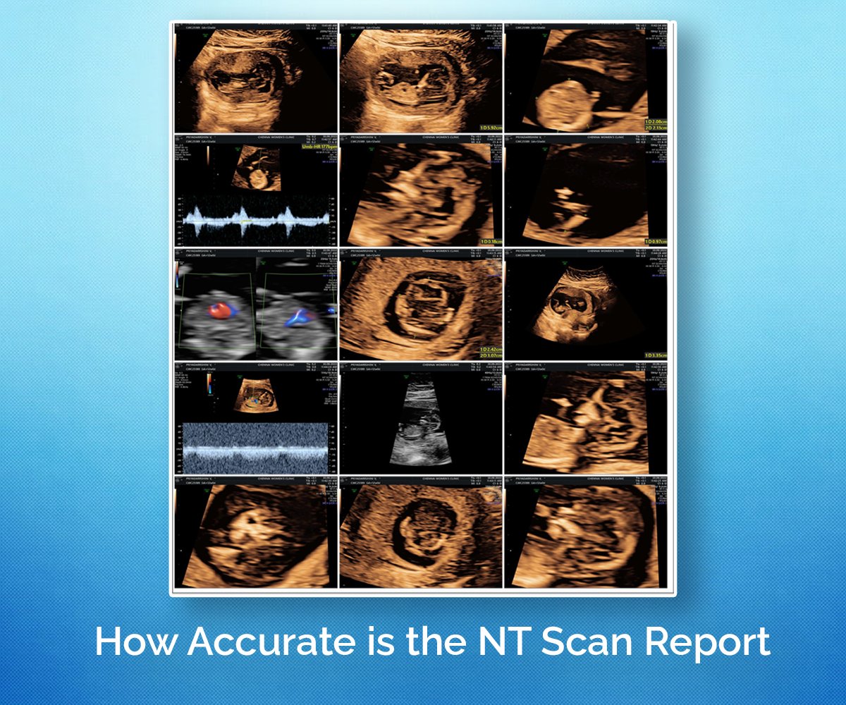 NT scan results accuracy