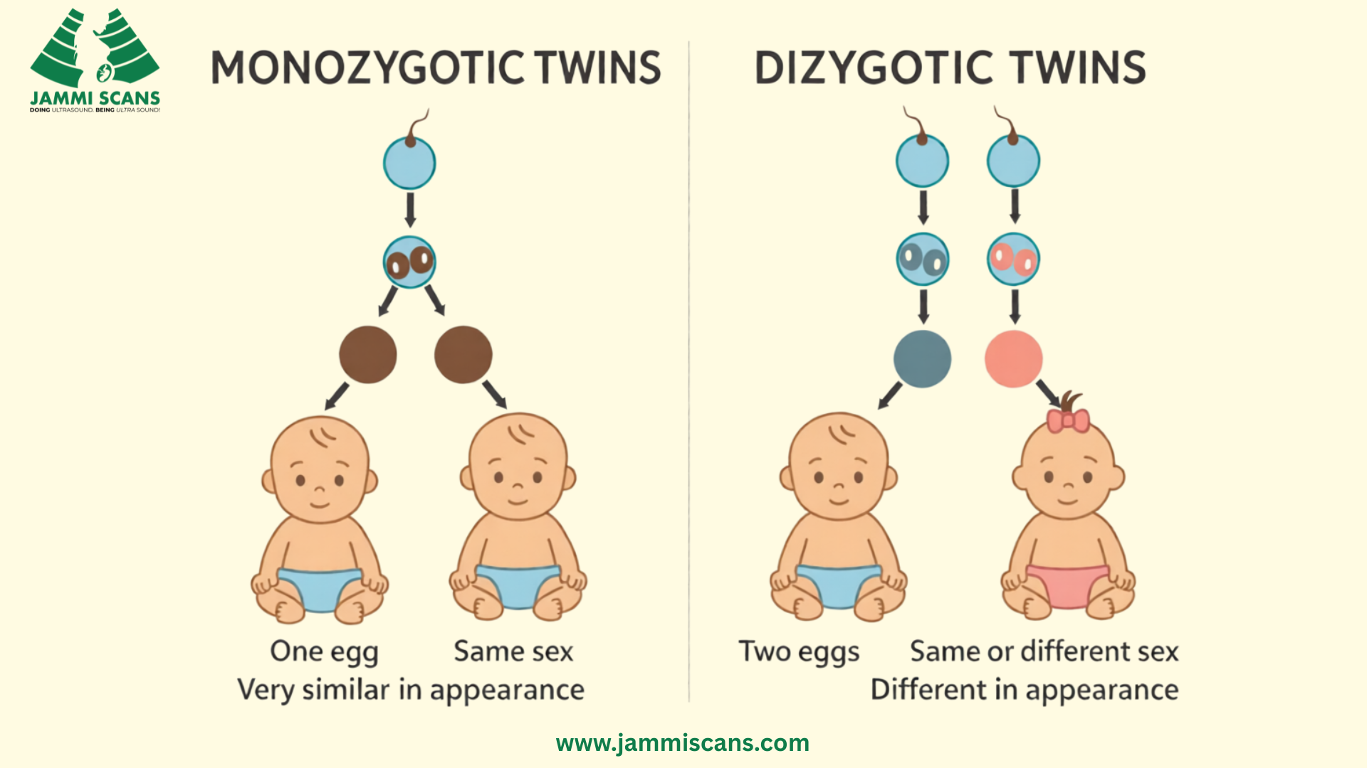 Types of Twin Pregnancies Monozygotic and Dizygotic