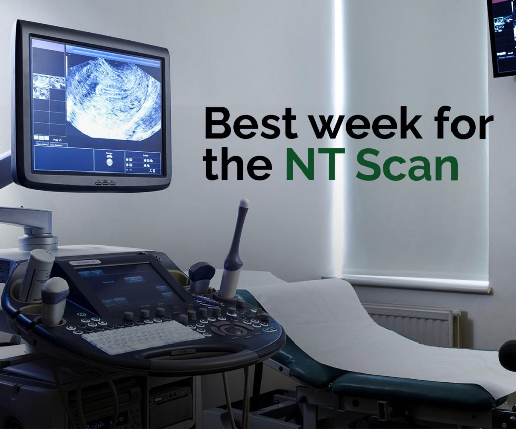 check Best week for the NT Scan in 2022