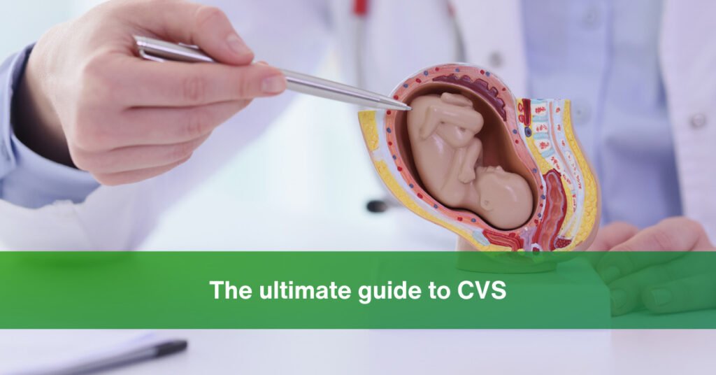 the ultimate guide to cvs