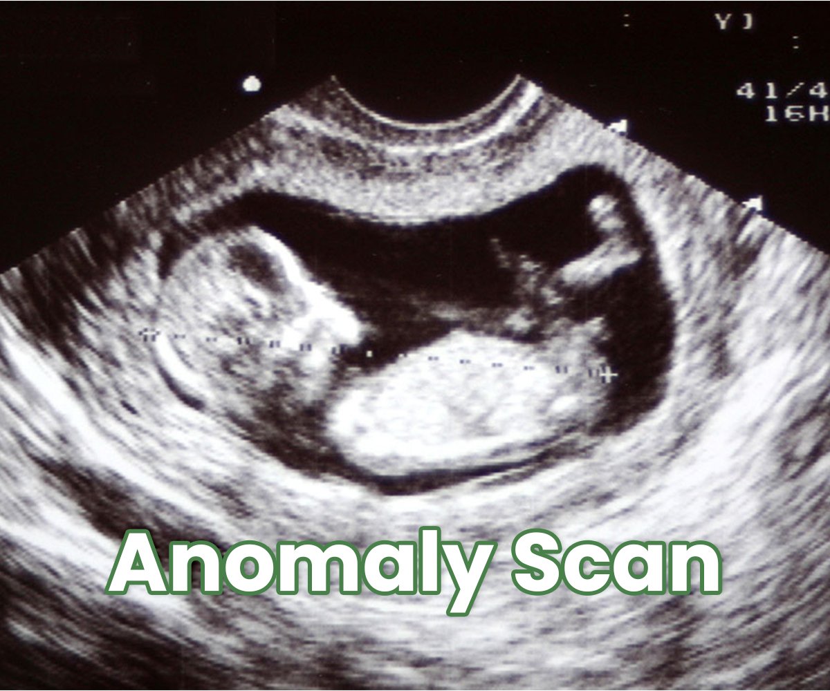 Anomaly Scan Video Dr Deepthi Jammi S Explanation Anomaly Scan Video Dr Deepthi Jammi S Explanation