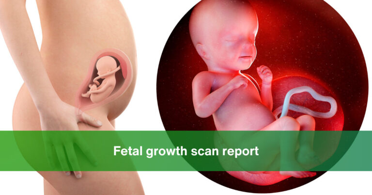 Pregmency Scan Report Fetal Growth Scan Report: A Step-by-Step Guide
