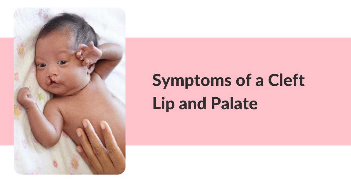 symptoms of cleft lip and cleft palate