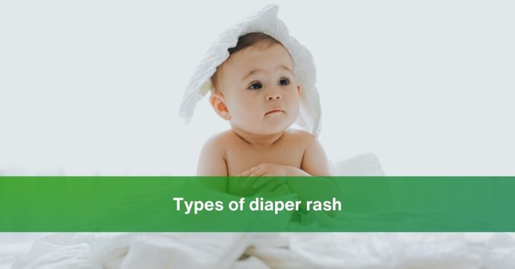 diaper rash in babies
