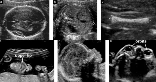 Baby Ultrasound Illustration