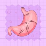 Stomach