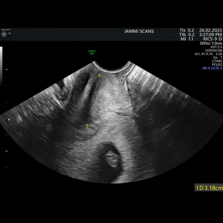 early pregnancy scan image