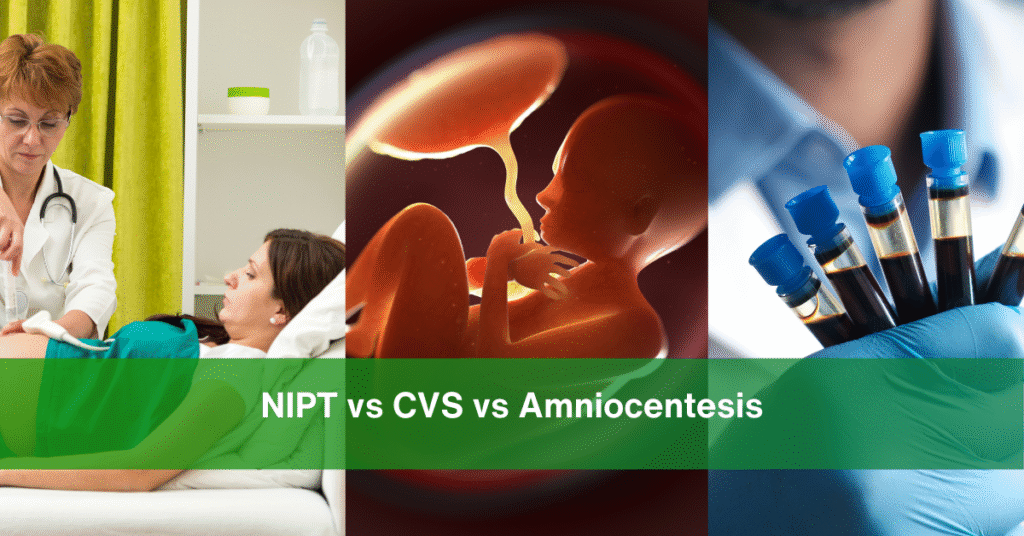 NIPT vs CVS vs Amniocentesis