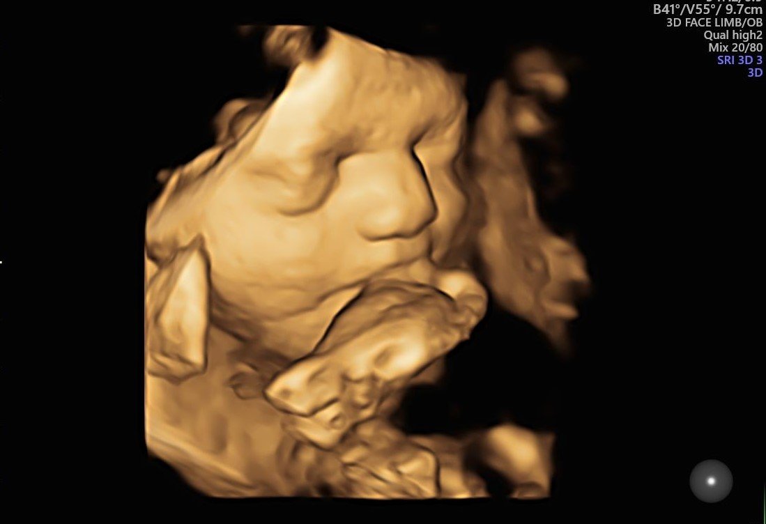 30 Weeks 3D image