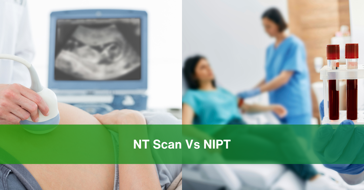 NT Scan Vs NIPT
