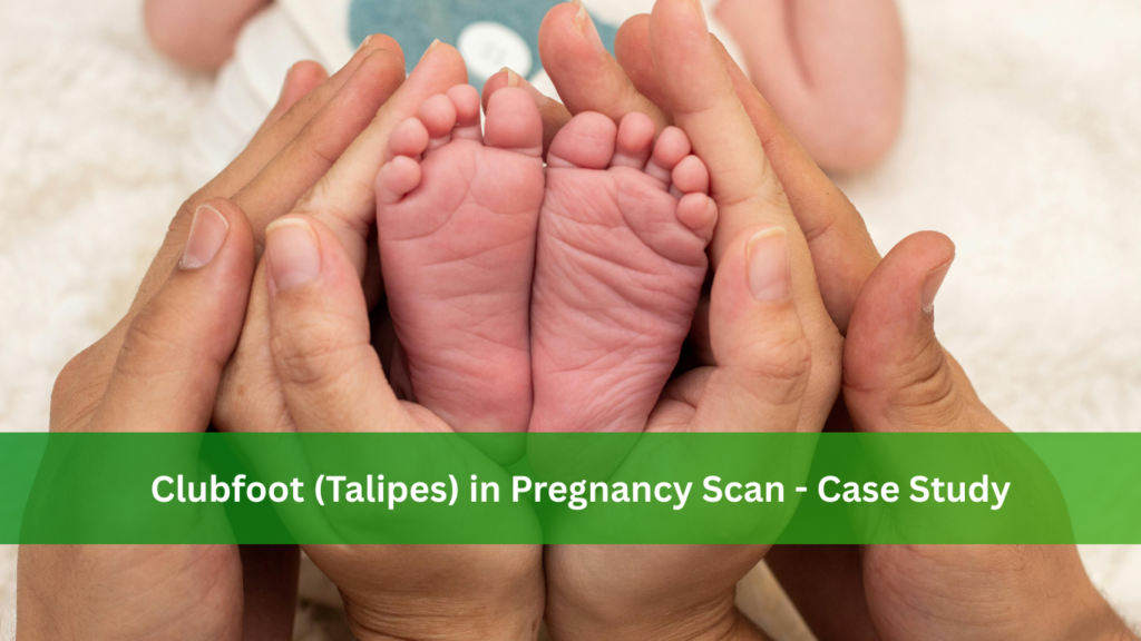 Clubfoot (Talipes) in Pregnancy Scan Case Study
