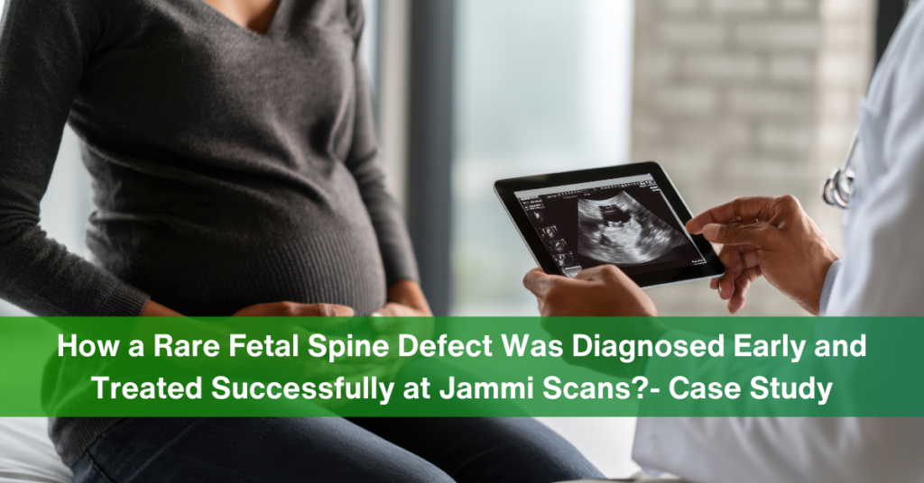 fetal spine defect (1)
