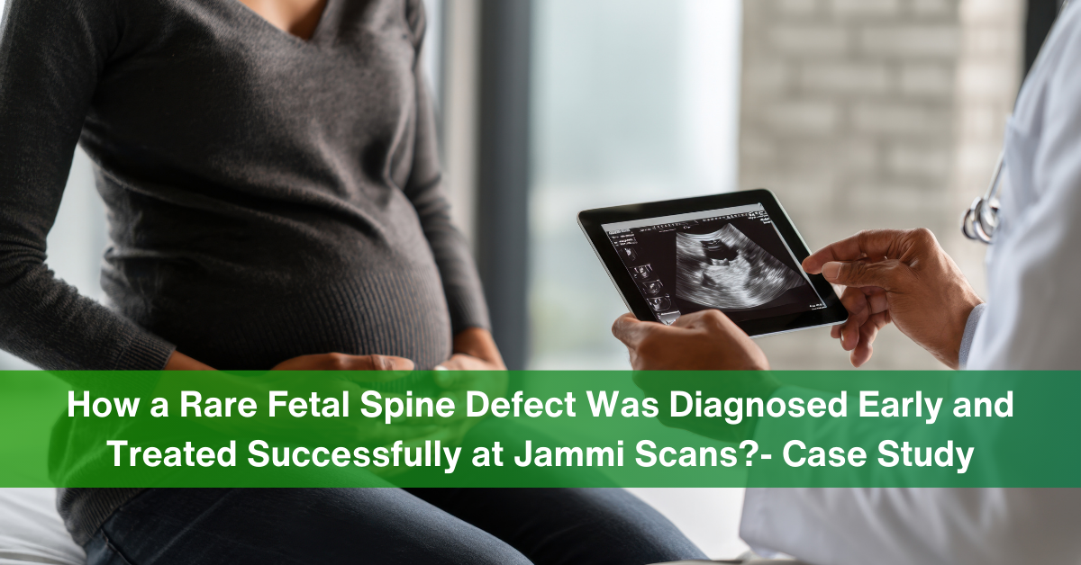fetal spine defect (1)