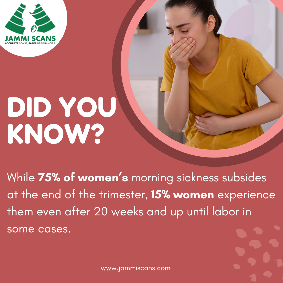 did you know moring sickness