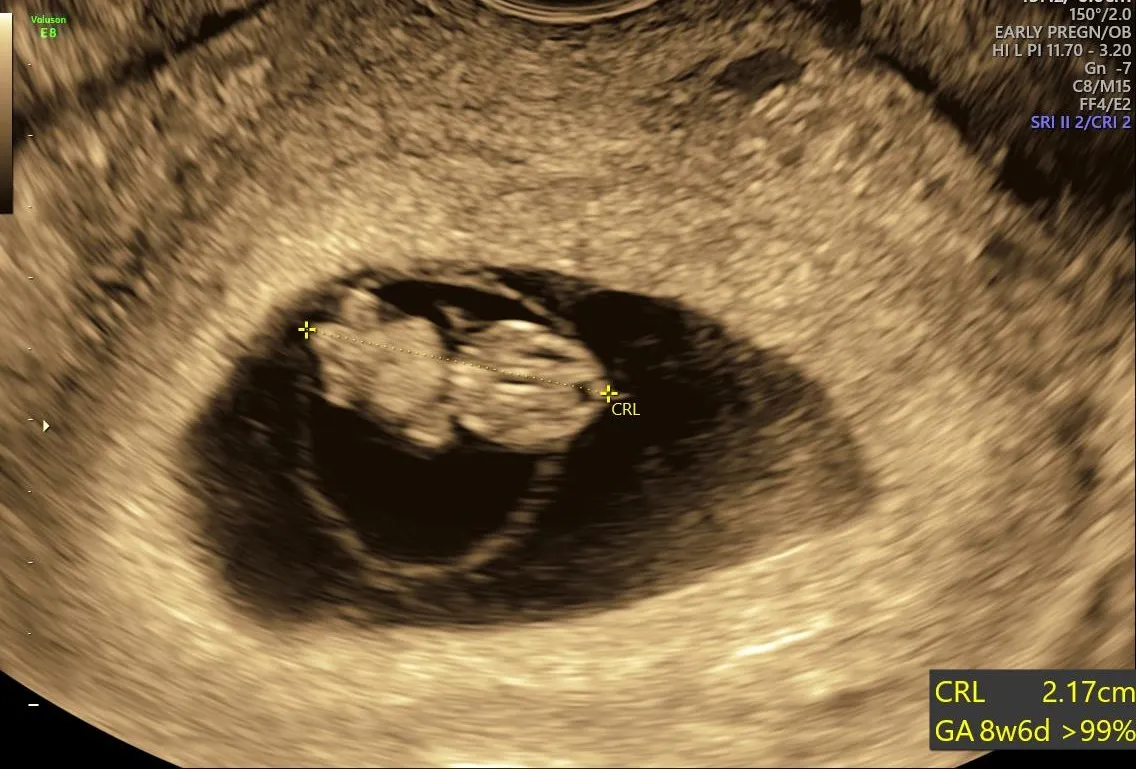Ultrasound Scan Illustration