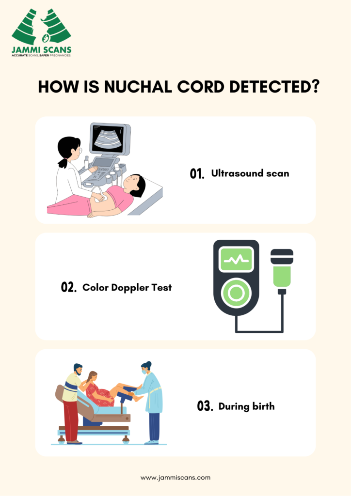 How is Nuchal Cord Detected
