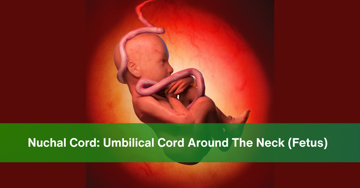 Nuchal Cord Umbilical Cord Around The Neck (Fetus)