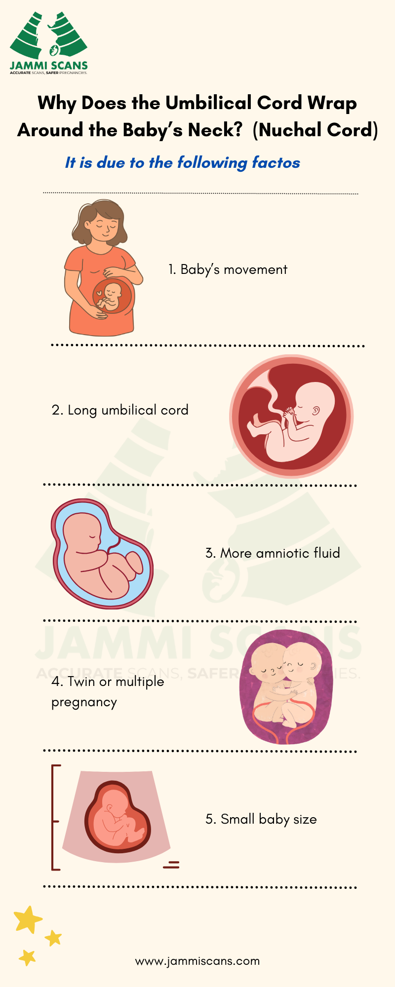 causes of umbilical cord around the baby's neck