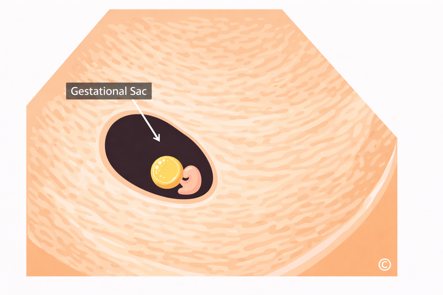 Ultrasound Abnormalities in the head/skull