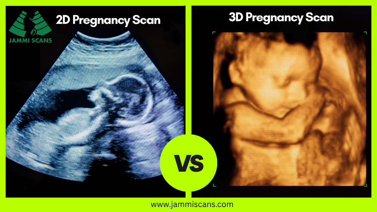 2D Vs 3D Pregnancy Scan