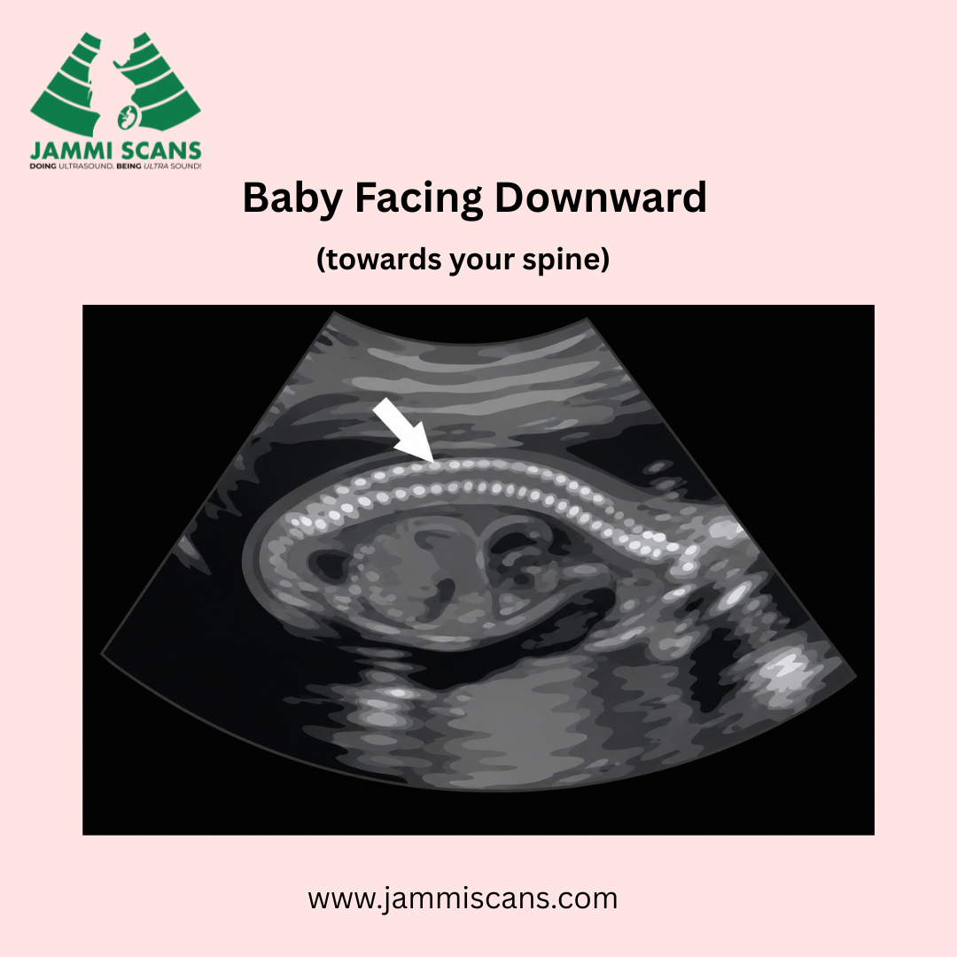 Baby Facing Downward