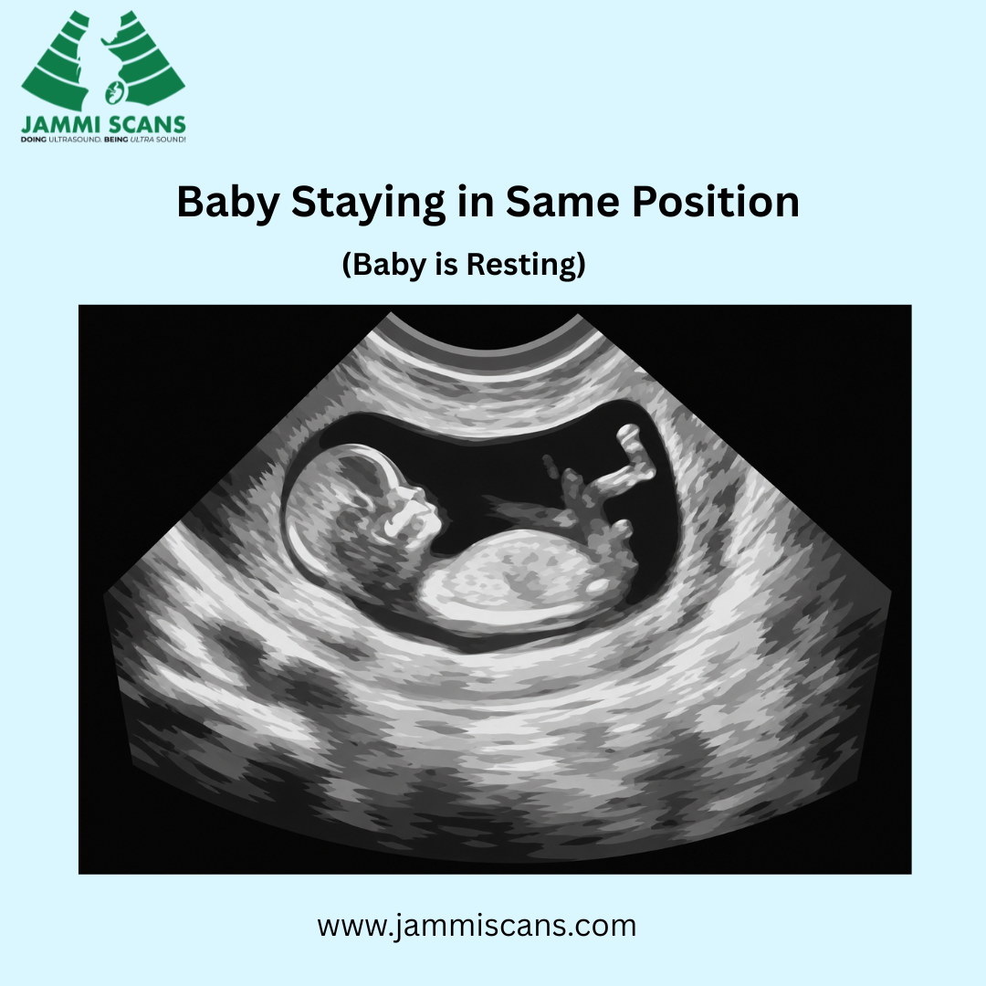Baby Staying in Same Position
