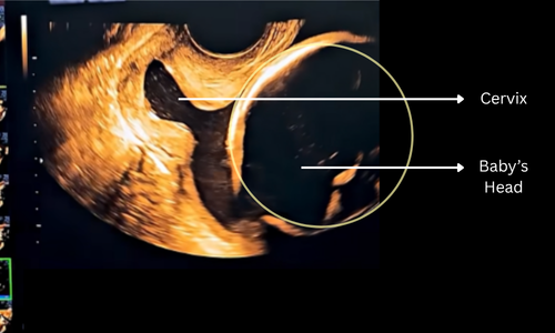 Ultrasound Scan Illustration
